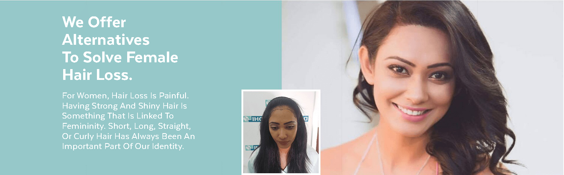 Female hair restoration by DHI